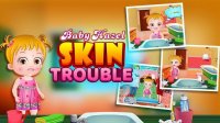 Baby Hazel Skin Trouble Care Game
