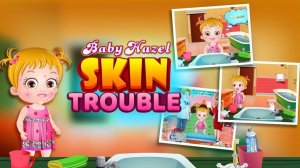 Baby Hazel Skin Trouble Care Game